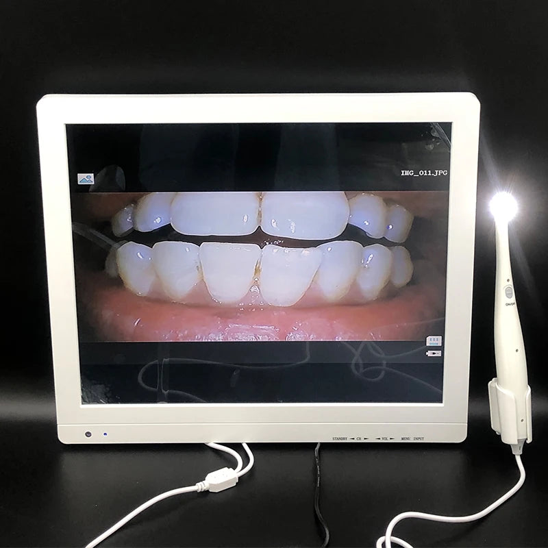 Camara Intraoral Alámbrica con Iluminación LED Compatible con Monitor y PC - Deposito Dental DentalShopMX