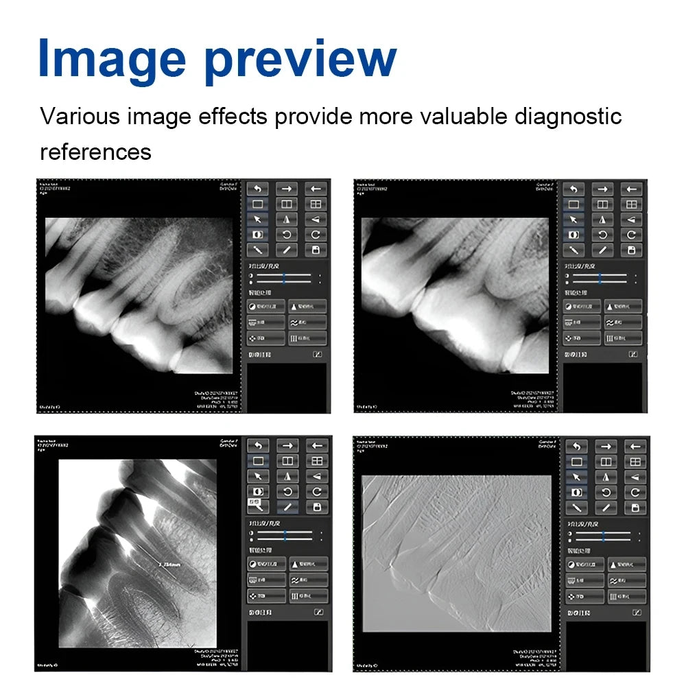 Radiovisografo Dental I-Sensor LYZDENT Adulto/Menor - Deposito Dental DentalShopMX