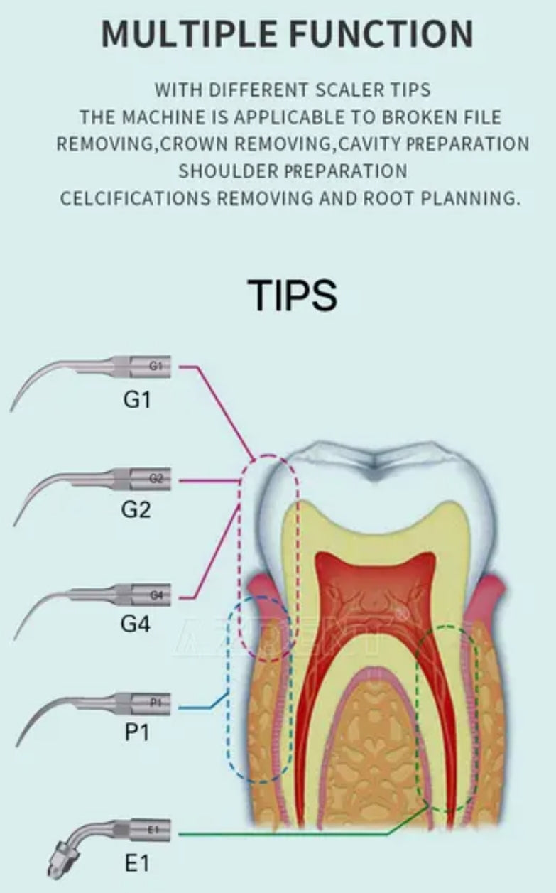 Escariador Dental ultrasónico con Control Inalambrico y Vaso de Alimentación - Deposito Dental DentalShopMX